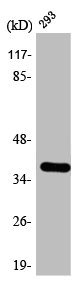 Western Blot analysis of 293 cells using 17beta-HSD11 Polyclonal Antibody Western Blot analysis of 293 cells using 17beta-HSD11 Polyclonal Antibody