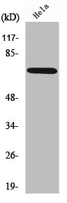 Western Blot analysis of HeLa cells using ABCF2 Polyclonal Antibody