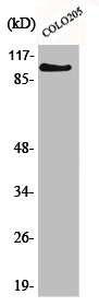 Western Blot analysis of Jurkat cells using AF-10 Polyclonal Antibody