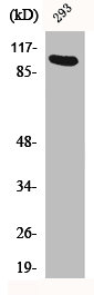 Western Blot analysis of 293 cells using Ah Receptor Polyclonal Antibody Western Blot analysis of 293 cells using Ah Receptor Polyclonal Antibody