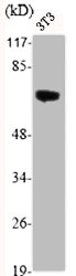 Western Blot analysis of NIH-3T3 cells using Akt Polyclonal Antibody