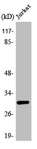 Western Blot analysis of Jurkat cells using ATF-5 Polyclonal Antibody