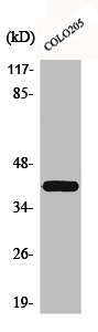 Western Blot analysis of COLO205 cells using Brp16 Polyclonal Antibody
