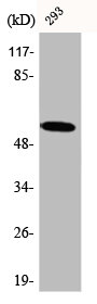 Western Blot analysis of 293 cells using CA IX Polyclonal Antibody Western Blot analysis of 293 cells using CA IX Polyclonal Antibody