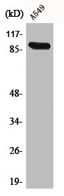 Western Blot analysis of A549 cells using Cadherin-16 Polyclonal Antibody Western Blot analysis of A549 cells using Cadherin-16 Polyclonal Antibody