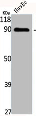 Western Blot analysis of HuvEc cells using Cadherin-16 Polyclonal Antibody