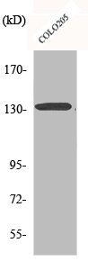 Western Blot analysis of COLO205 cells using CARD 11 Polyclonal Antibody