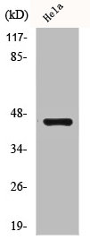 Western Blot analysis of Jurkat cells using Casein Kinase IIalpha Polyclonal Antibody Western Blot analysis of Jurkat cells using Casein Kinase IIalpha Polyclonal Antibody