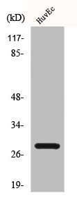Western Blot analysis of HuvEc cells using Casein Kinase IIbeta Polyclonal Antibody Western Blot analysis of HuvEc cells using Casein Kinase IIbeta Polyclonal Antibody