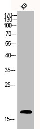 Western Blot analysis of KB cells using Caspase-3 Polyclonal Antibody Western Blot analysis of KB cells using Caspase-3 Polyclonal Antibody