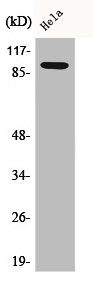 Western Blot analysis of HeLa cells using Catenin-beta1 Polyclonal Antibody Western Blot analysis of HeLa cells using Catenin-beta1 Polyclonal Antibody