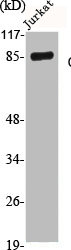 Western Blot analysis of Jurkat cells using Catenin-beta1 Polyclonal Antibody
