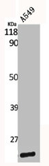 Western Blot analysis of A549 cells using Caveolin-1 Polyclonal Antibody