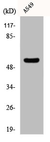 Western Blot analysis of Jurkat cells using CHST2 Polyclonal Antibody