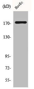 Western Blot analysis of HuvEc cells using COL11A2 Polyclonal Antibody Western Blot analysis of HuvEc cells using COL11A2 Polyclonal Antibody