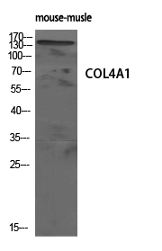Western Blotting(WB) 1- COL4A1 Antibody