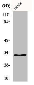 Western Blot analysis of HuvEc cells using COX6c Polyclonal Antibody Western Blot analysis of HuvEc cells using COX6c Polyclonal Antibody