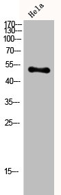 Western Blot analysis of Hela cells using CPN cat Polyclonal Antibody Western Blot analysis of Hela cells using CPN cat Polyclonal Antibody