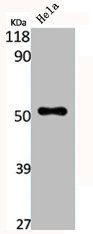 Western Blot analysis of HELA cells using CPN cat Polyclonal Antibody