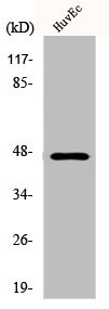Western Blot analysis of HuvEc cells using Cytokeratin 18 Polyclonal Antibody Western Blot analysis of HuvEc cells using Cytokeratin 18 Polyclonal Antibody