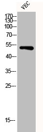 Western Blot analysis of VEC cells using Desmin Polyclonal Antibody