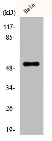 Western Blot analysis of HepG2 cells using Desmin Polyclonal Antibody