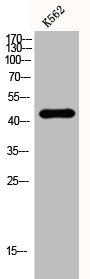 CSB-PA002145 WB-1