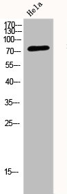 Western Blot analysis of HELA cells using DRP1 Polyclonal Antibody Western Blot analysis of HELA cells using DRP1 Polyclonal Antibody