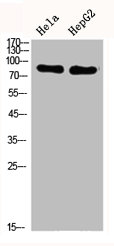 Western Blot analysis of HELA HepG2 cells using DRP1 Polyclonal Antibody
