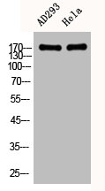 Western Blotting(WB) 2- EGFR Antibody