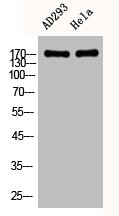 Western Blot analysis of AD293 HELA cells using EGFR Polyclonal Antibody