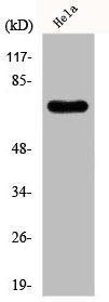 Western Blot analysis of Hela cells using FBP2 Polyclonal Antibody