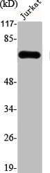 Western Blot analysis of Jurkat cells using FBP2 Polyclonal Antibody