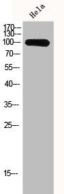 Western Blot analysis of Hela cells using GCN5 Polyclonal Antibody