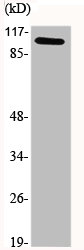 Western Blot analysis of various cells using GCN5 Polyclonal Antibody