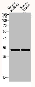 Western blot analysis of Mouse-kidney mouse-brain lysis using GCSm-gamma antibody.