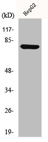 Western Blot analysis of HepG2 cells using MMP-9 Polyclonal Antibody Western Blot analysis of HepG2 cells using MMP-9 Polyclonal Antibody