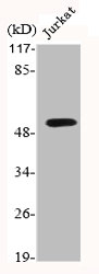 Western Blotting(WB) 2- GSK3A Antibody