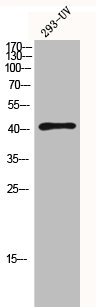 Western Blotting(WB) 1- HDAC8 Antibody