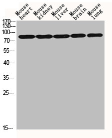 Western Blotting(WB) 2- HIF1A Antibody