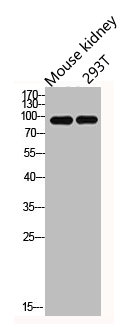 Western Blotting(WB) 2- IL4R Antibody