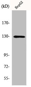 Western Blot analysis of HepG2 cells using Integrin beta3 Polyclonal Antibody Western Blot analysis of HepG2 cells using Integrin beta3 Polyclonal Antibody