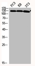 Western Blot analysis of PC3 KB NIH-3T3 cells using JAK2 Polyclonal Antibody