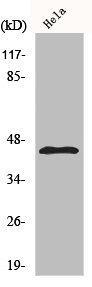 Western Blot analysis of Hela cells using KIR6.2 Polyclonal Antibody