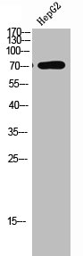 Western Blot analysis of HEPG2 using LIMK-1/2 Polyclonal Antibody.
