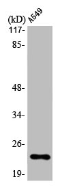 Western Blot analysis of A549 cells using MAD2 Polyclonal Antibody