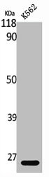 Western Blot analysis of K562 cells using MAD2 Polyclonal Antibody