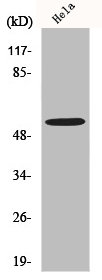 Western Blot analysis of K562 cells using MLKL Polyclonal Antibody Western Blot analysis of K562 cells using MLKL Polyclonal Antibody