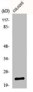 Western Blot analysis of 293 cells using NDUFB9 Polyclonal Antibody