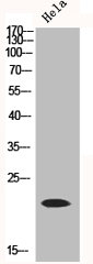 Western Blot analysis of HELA cells using NDUFB9 Polyclonal Antibody